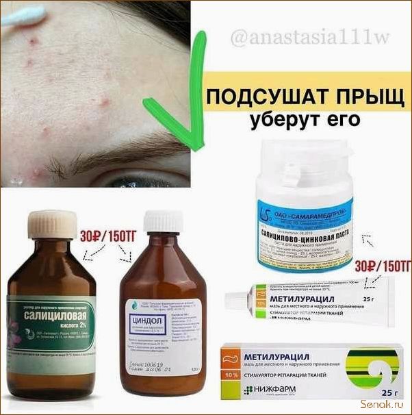 Как избавиться от прыщей и акне с помощью посещения сауны — эффективные методы и рекомендации