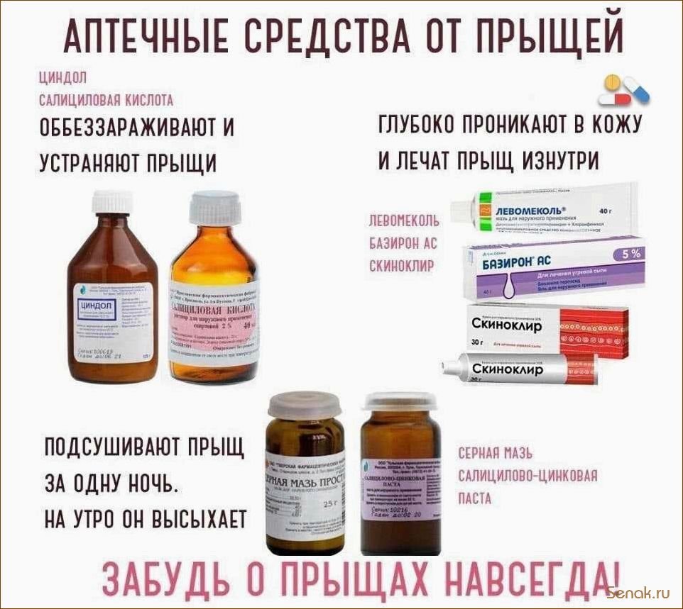 Как избавиться от прыщей и акне с помощью посещения сауны — эффективные методы и рекомендации