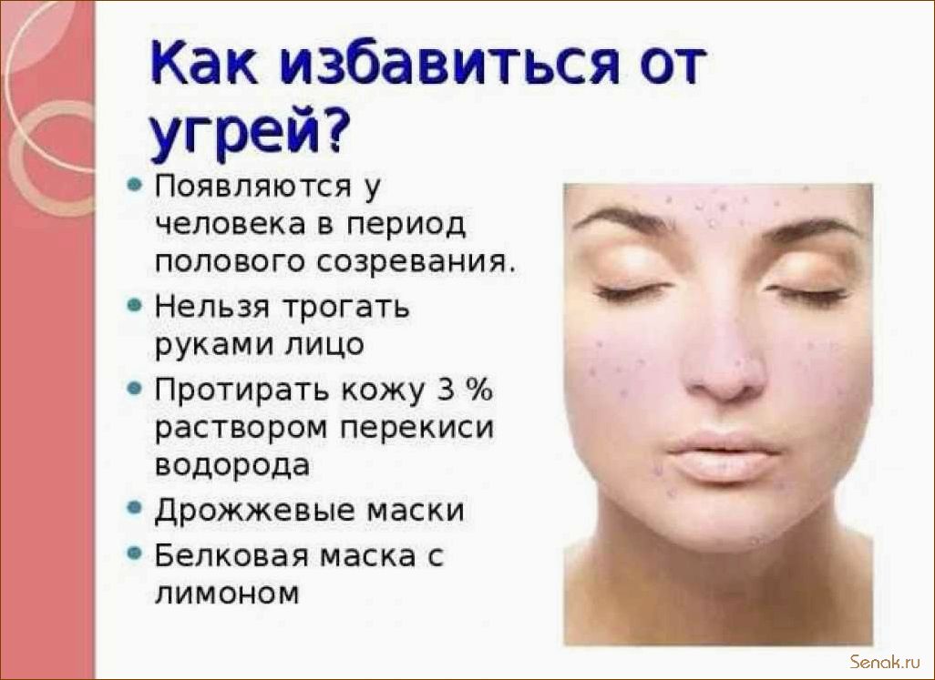 Как избавиться от прыщей и акне с помощью посещения сауны — эффективные методы и рекомендации